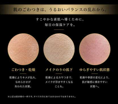スムーススキン クリーム